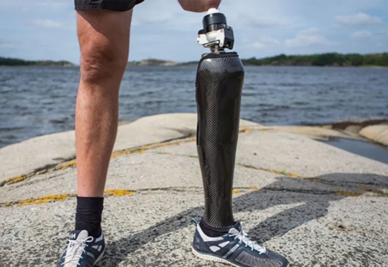Osseointegration prosthetic leg demonstrating durability in New York, New Jersey, & Connecticut