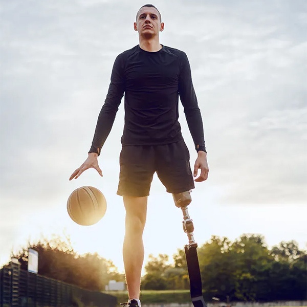 Osseointegration prosthetic leg supporting athletic movement in New York, New Jersey, & Connecticut