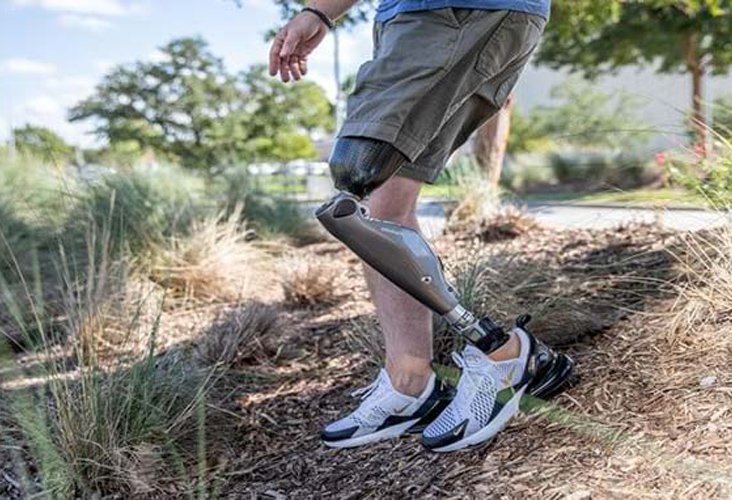 Man on Hill Walking with a Prosthetic Leg in New York and New Jersey