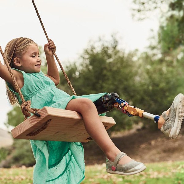 A Child Swinging with an Osseointegration Prosthesis in New York, New Jersey, and Connecticut