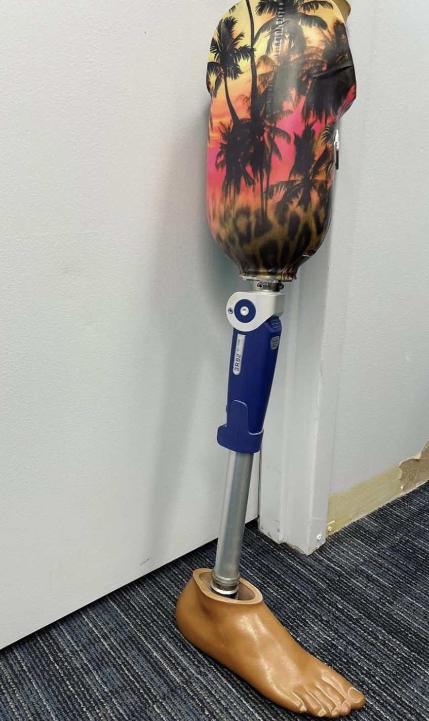 Colorful Graphics on Prosthetic Limb Displayed in New York, New Jersey, and Connecticut