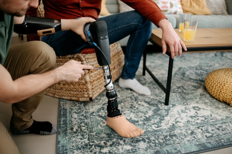 Featured image for “The Prosthetic Fitting Process: What to Expect”