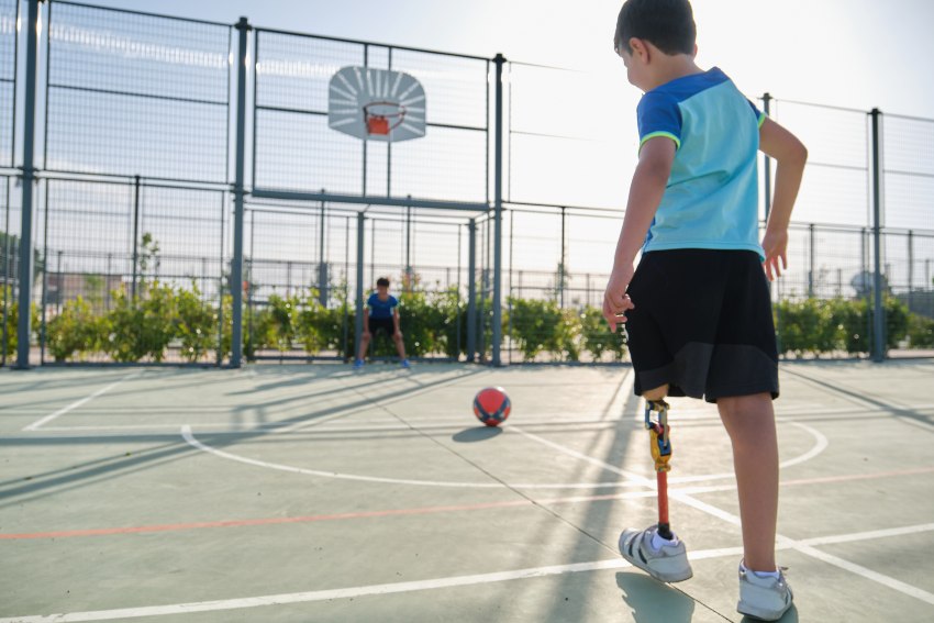 Featured image for “The Challenges of Providing Prosthetics for Growing Children”