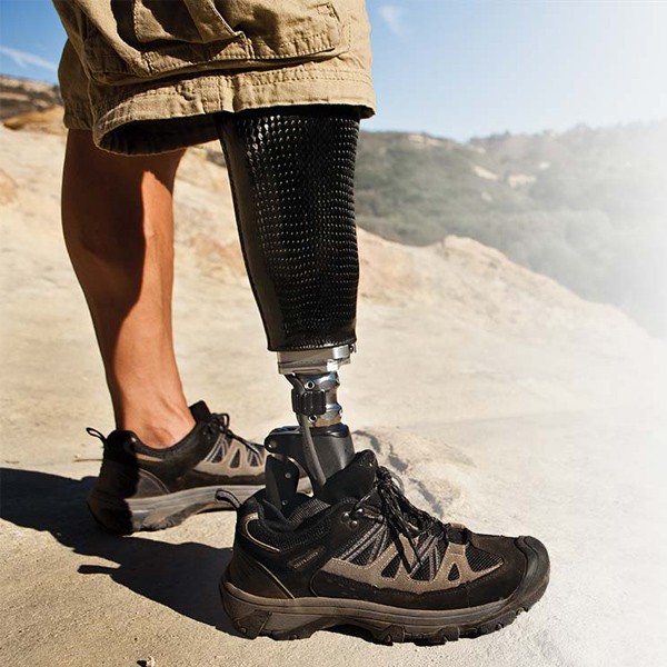 Prosthetics Care Enhances Outdoor Mobility in New York, New Jersey, and Connecticut