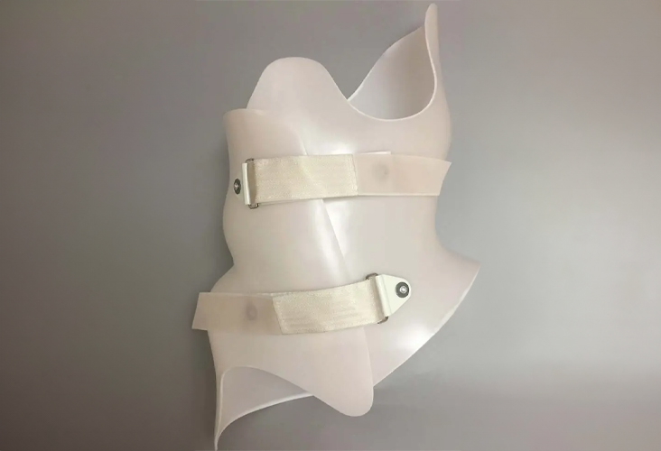 Boston Brace RC (Rigo-Cheneau) Scoliosis Brace